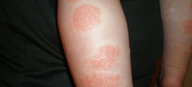 Причины заболеваний зубов: психосоматика