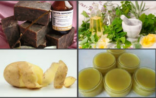 Дерматит – народная медицина/ народные средства от кожного дерматита