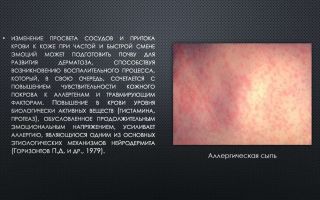 Проблемы с кожей: психосоматика