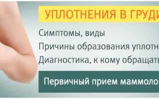 Уплотнение молочных желёз: причины, факторы и диагностика