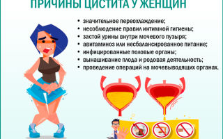 Цистит у женщин: причины и лечение