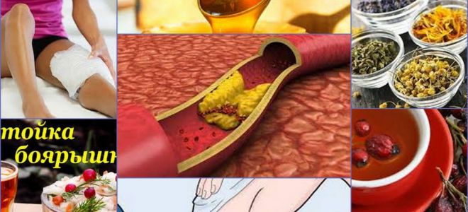 Атеросклероз и его лечение — народные рецепты