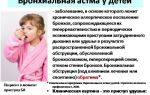 Бронхиальная астма у детей: симптомы и причины заболевания