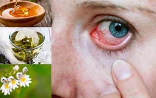 Бородавки — как вылечить бородавки народными средствами / народная медицина