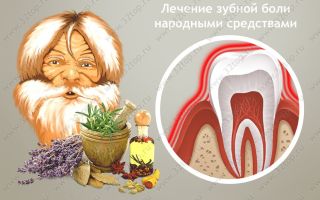 Зубная боль народные средства и рецепты / народная медицина