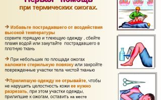 Особенности оказания первой помощи при термических ожогах