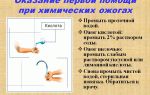 Оказание первой помощи при химических ожогах