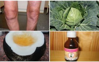 Неврозы лечение народными средствами / народная медицина