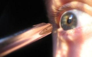 Айхмофобия — страх ножей и других острых предметов