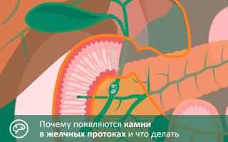 Камни в желчном пузыре и желчных протоках – народные средства и методы / народная медицина