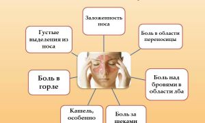 Гайморит: причины, симптомы и лечение