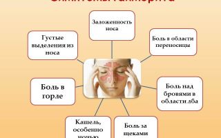 Гайморит: причины, симптомы и лечение