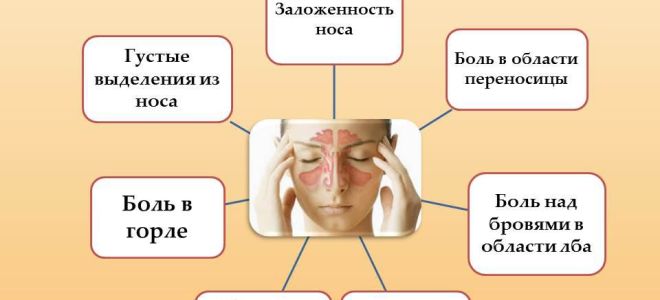 Гайморит: причины, симптомы и лечение