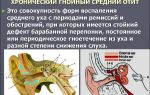 Хроническое воспаление среднего уха: лечение и профилактика