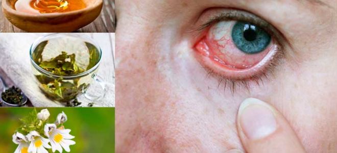 Глазные болезни у детей и взрослых – народные средства, народная медицина, народные рецепты