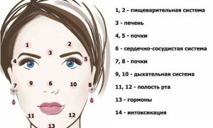 Прыщи и высыпания: психосоматика